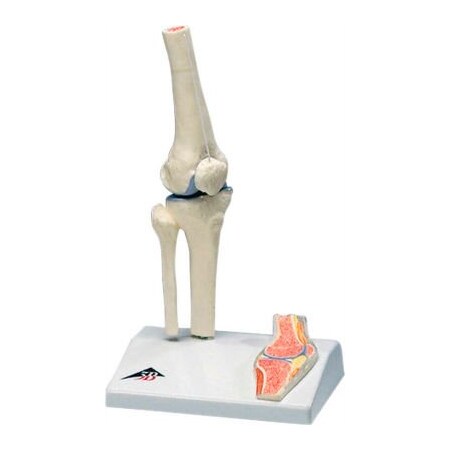Fabrication Enterprises 3B Anatomical Model - Mini Knee Joint with Cross Section of Bone on Base 956541